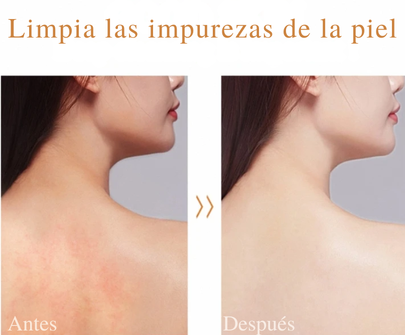 Jabón Cúrcuma y ácido Kójico. Aclara, repara e ilumina tu piel.