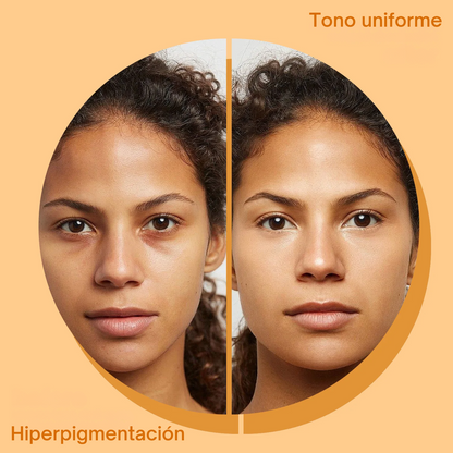 Jabón Cúrcuma y ácido Kójico. Aclara, repara e ilumina tu piel.